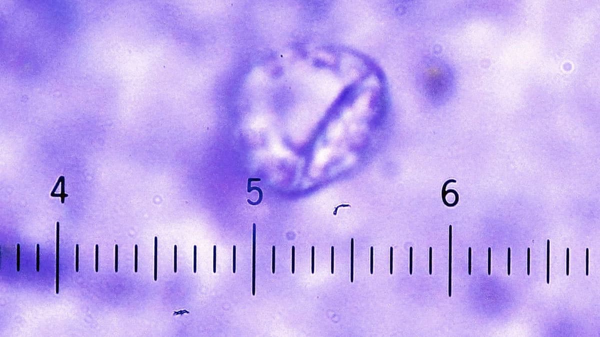 Cyclospora cayetanensis