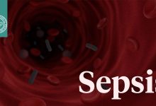 چالش‌ها و پیشرفت‌ها در تشخیص سپسیس