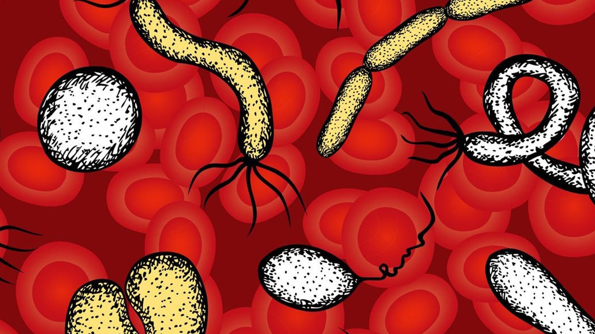 چالش‌های تشخیص سپسیس