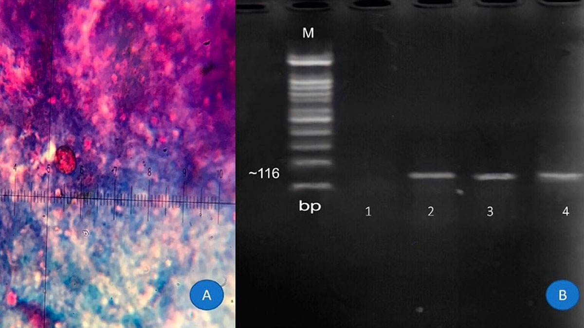 روش استاندارد تشخیص مولکولی Cyclospora cayetanensis در محصولات تازه