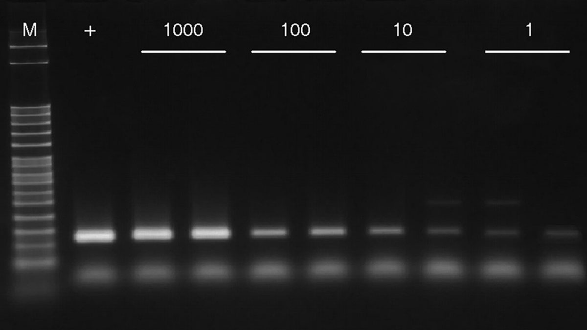 روش تشخیص مولکولی Cyclospora cayetanensis