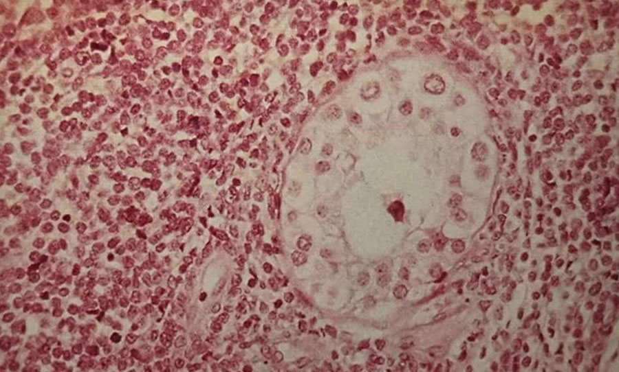 درگیری بیضه