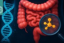 بیومارکرهای سرطان روده بزرگ