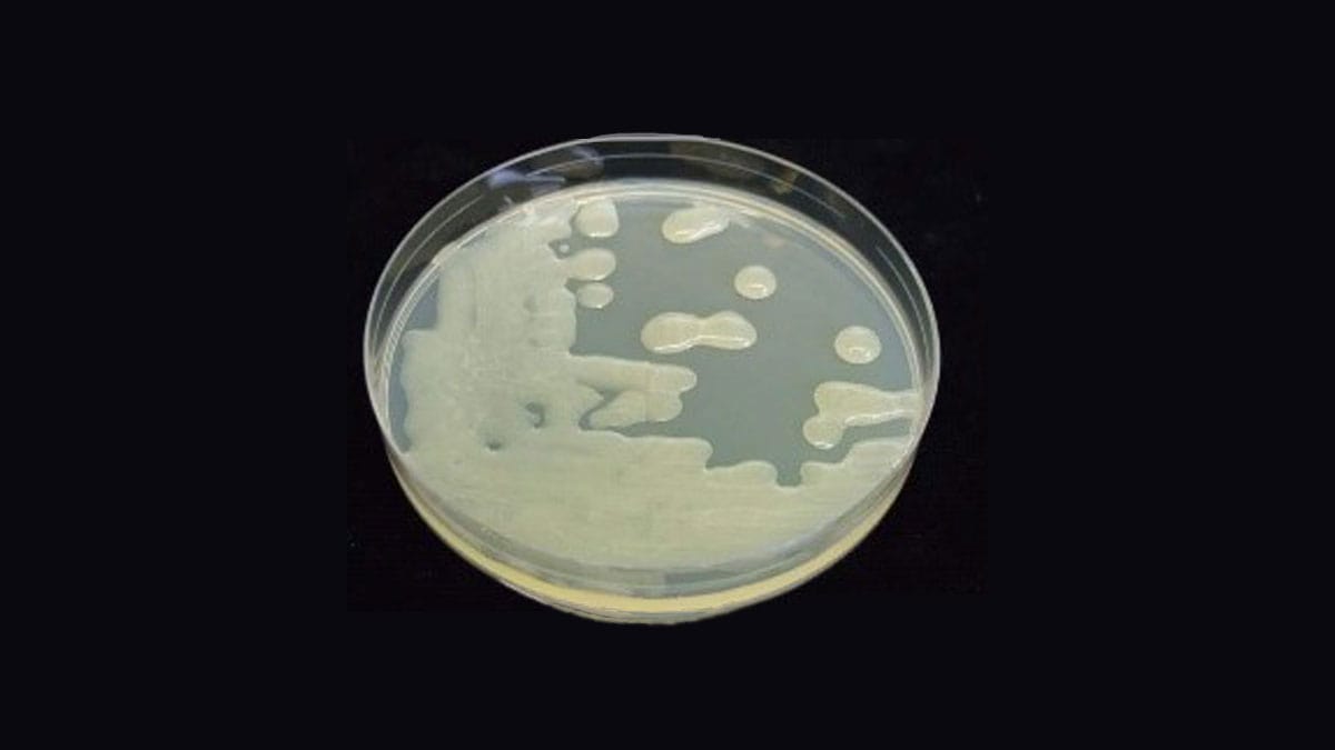 ریخت‌شناسی معمول کلنی Erwinia amylovora روی محیط کشت لووان (NSA)