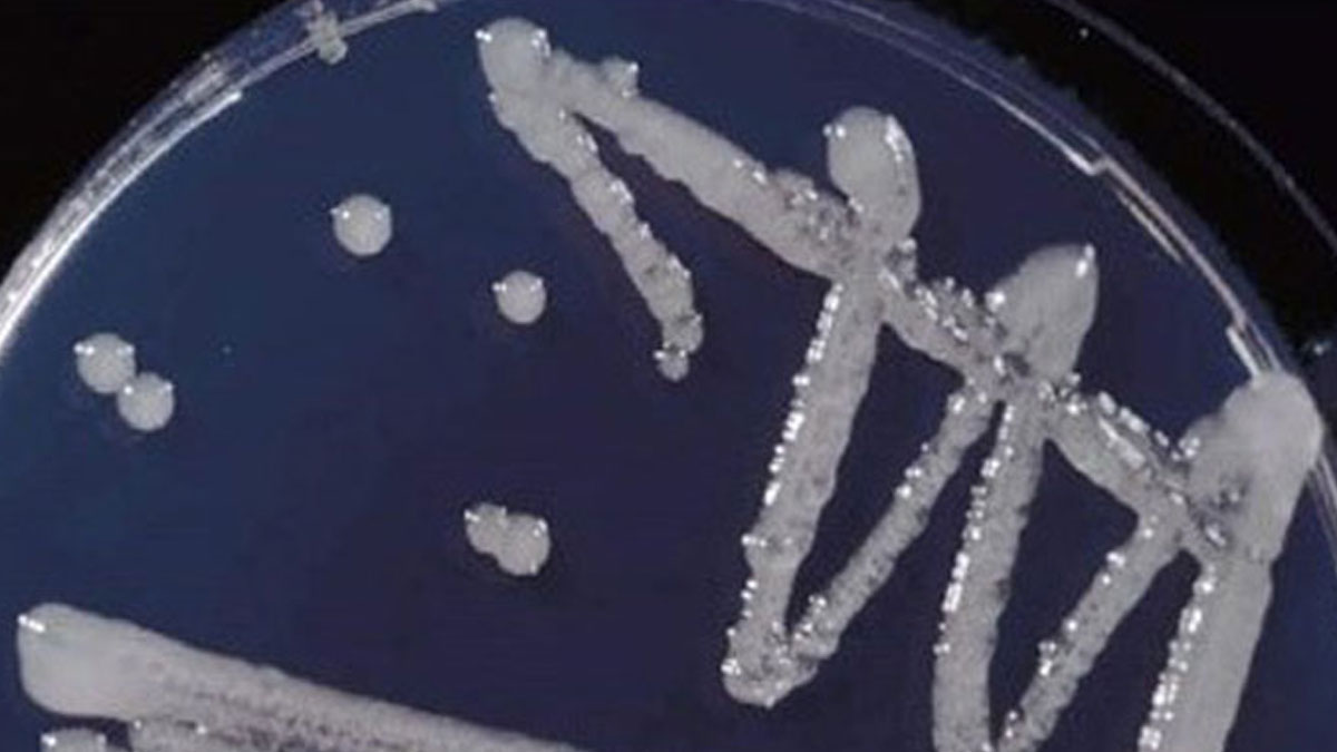 رشد باکتری Erwinia amylovora روی محیط کشت CCT