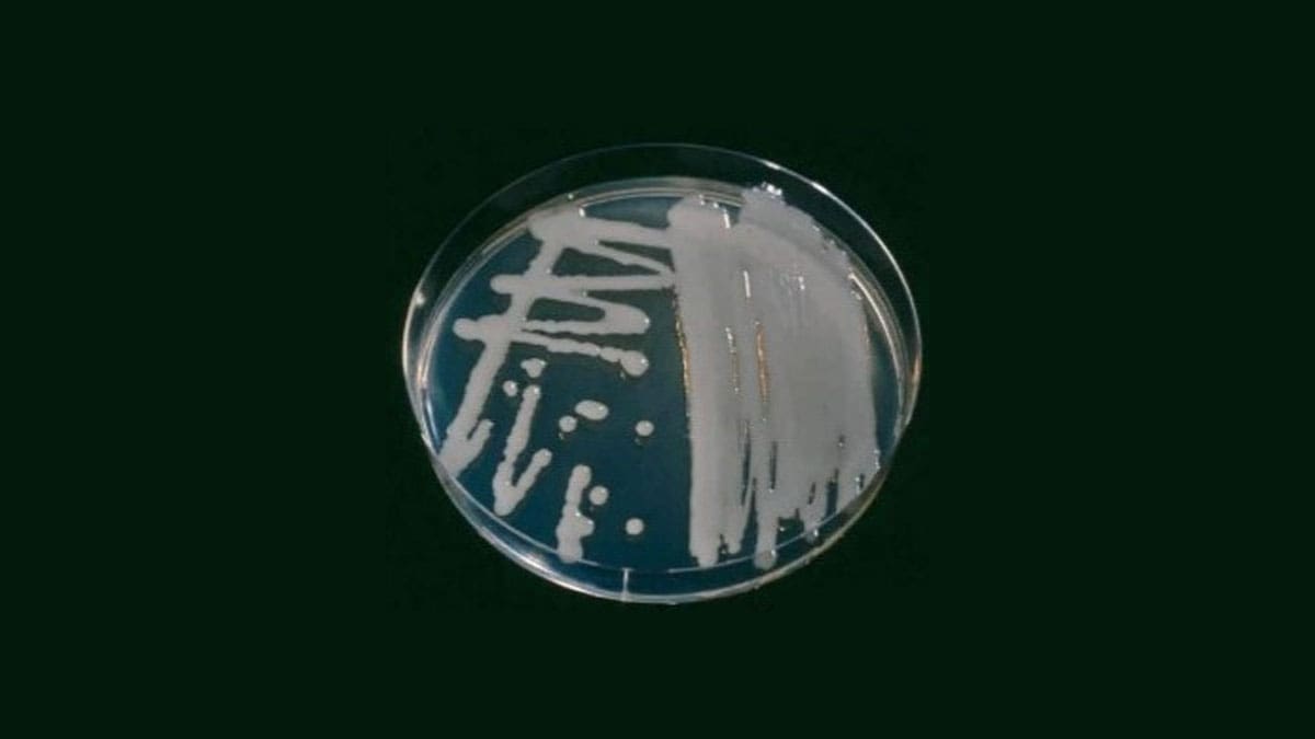 رشد Erwinia amylovora روی محیط کشت King’s B