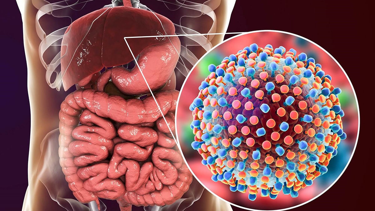 بیماری هپاتیت C
