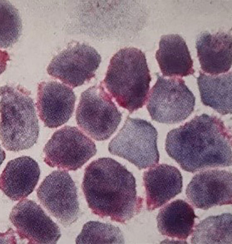 تصویر ایمونوسیتوشیمی با استفاده از آنتی‌بادی‌های مونوکلونال