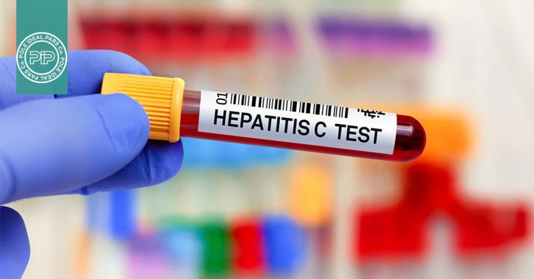 ۳ روش بهبود تشخیص هپاتیت