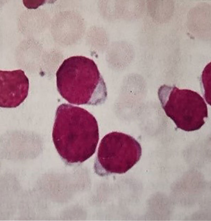 عکس گسترش خون محیطی