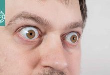 بیماری تیروئید چشمی