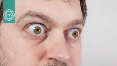 بیماری تیروئید چشمی