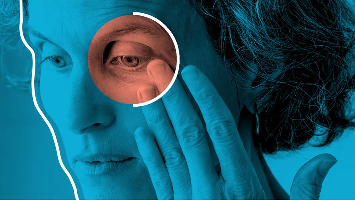 شناخت بیماری تیروئید چشمی