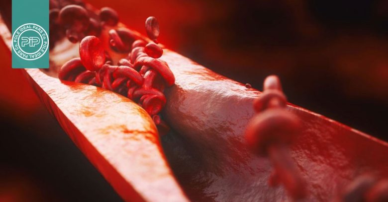 ارتباط چاقی احشایی و آسیب خاموش رگ‌ها