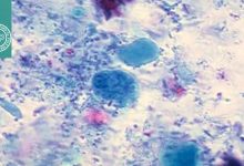 رنگ‌آمیزی تریکروم ویتلی