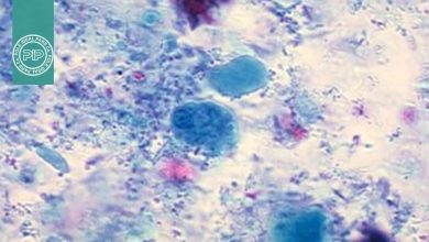 رنگ‌آمیزی تریکروم ویتلی