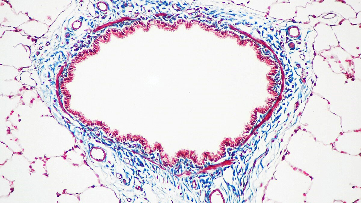رنگ‌آمیزی تریکروم ویتلی