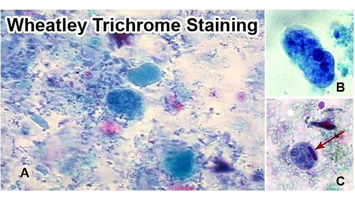 رنگ‌آمیزی تریکروم ویتلی