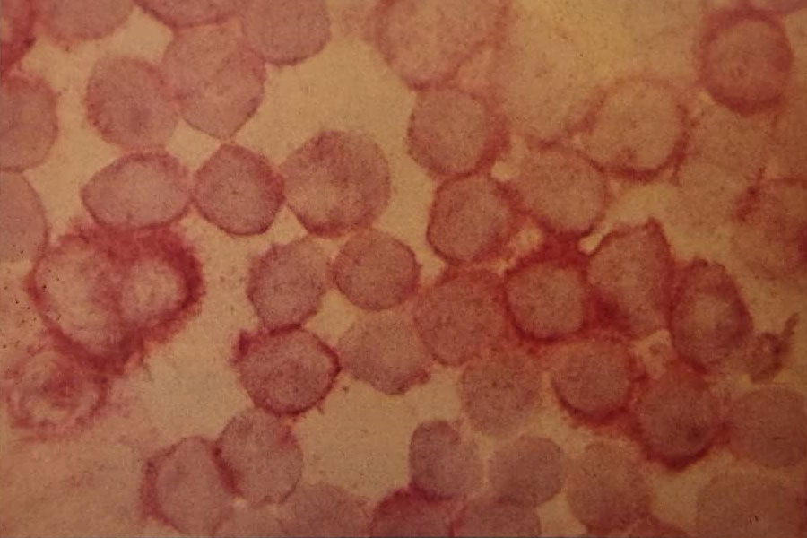 برای آنتی‌ژن‌های سلول T شامل CD2، CD3