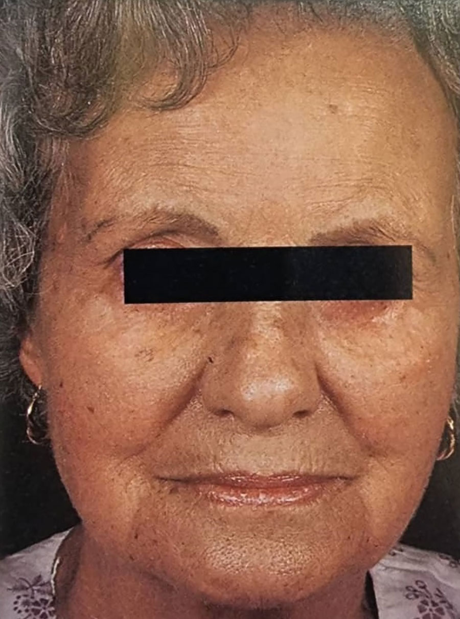 ظاهر صورت بیمار