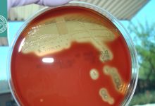 همولیز استرپتوکوک‌ ها