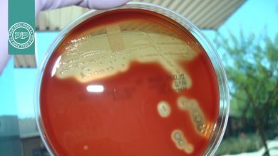 همولیز استرپتوکوک‌ ها