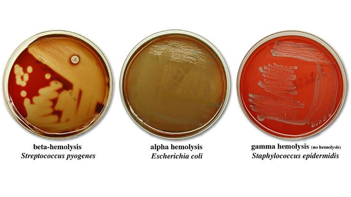 همولیز استرپتوکوک