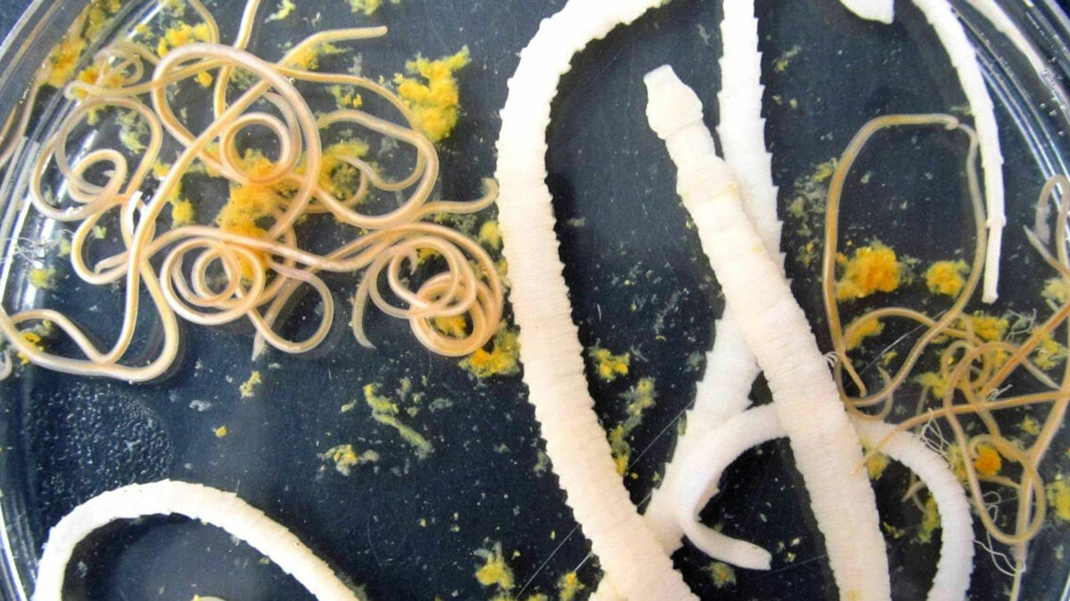 تشخیص آزمایشگاهی بیماری‌های انگلی