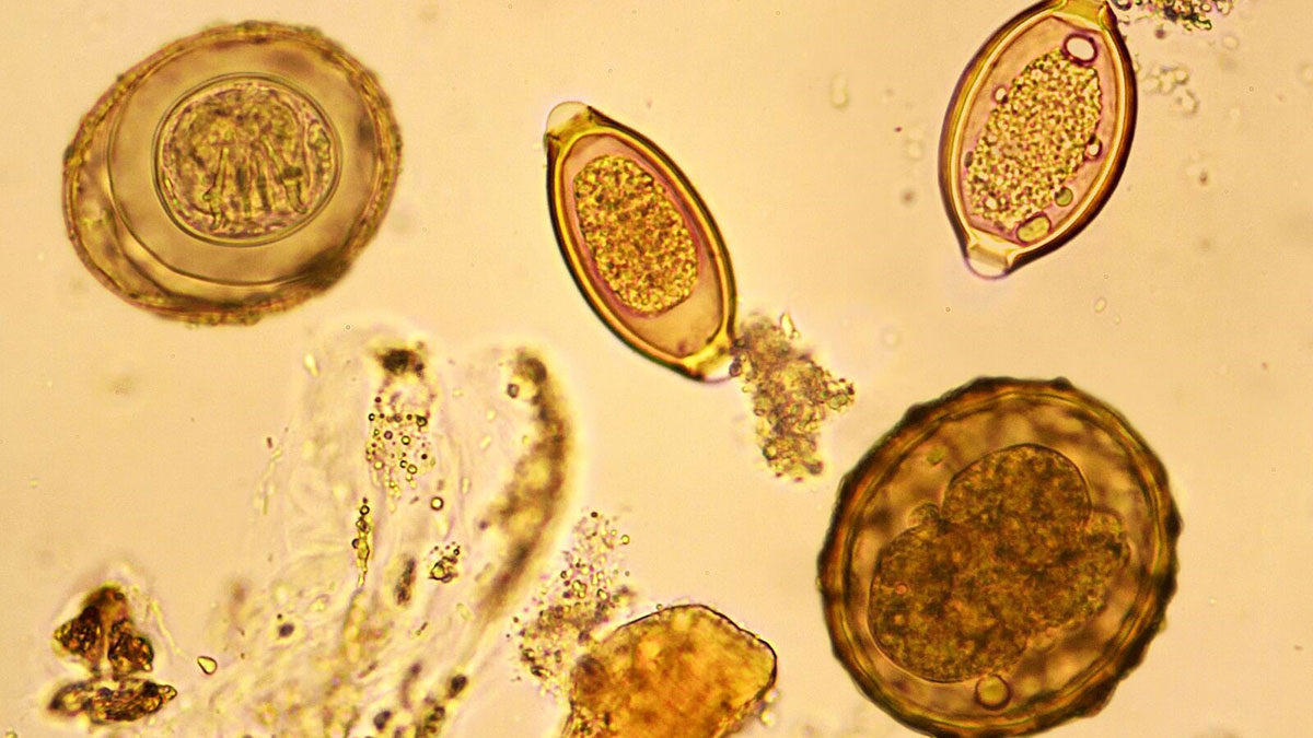 سفر یک انگل: از تولد تا انتقال در بیماری‌های انگلی