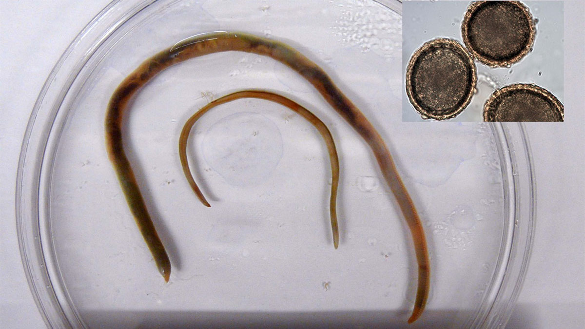 تشخیص آزمایشگاهی بیماری‌های انگلی