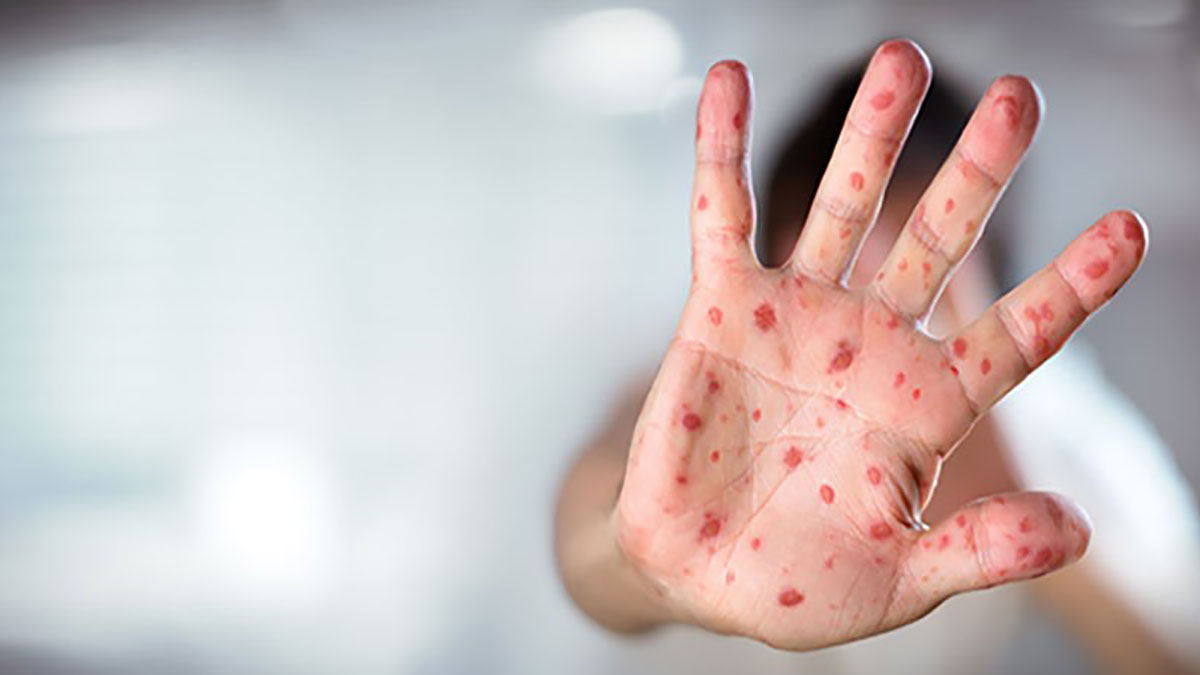 بی‌تفاوتی کشنده است