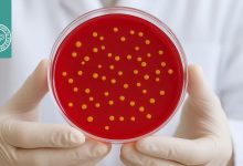 پتری دیش چیست؟