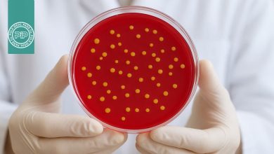 پتری دیش چیست؟