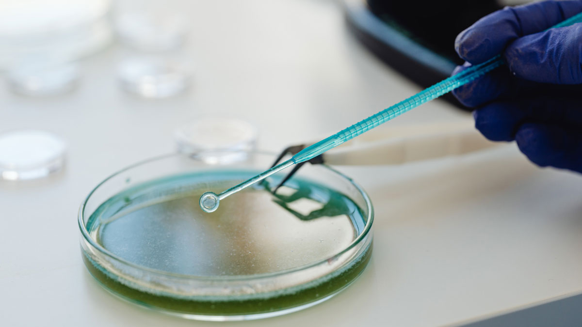 نکات احتیاطی هنگام استفاده از پتری دیش