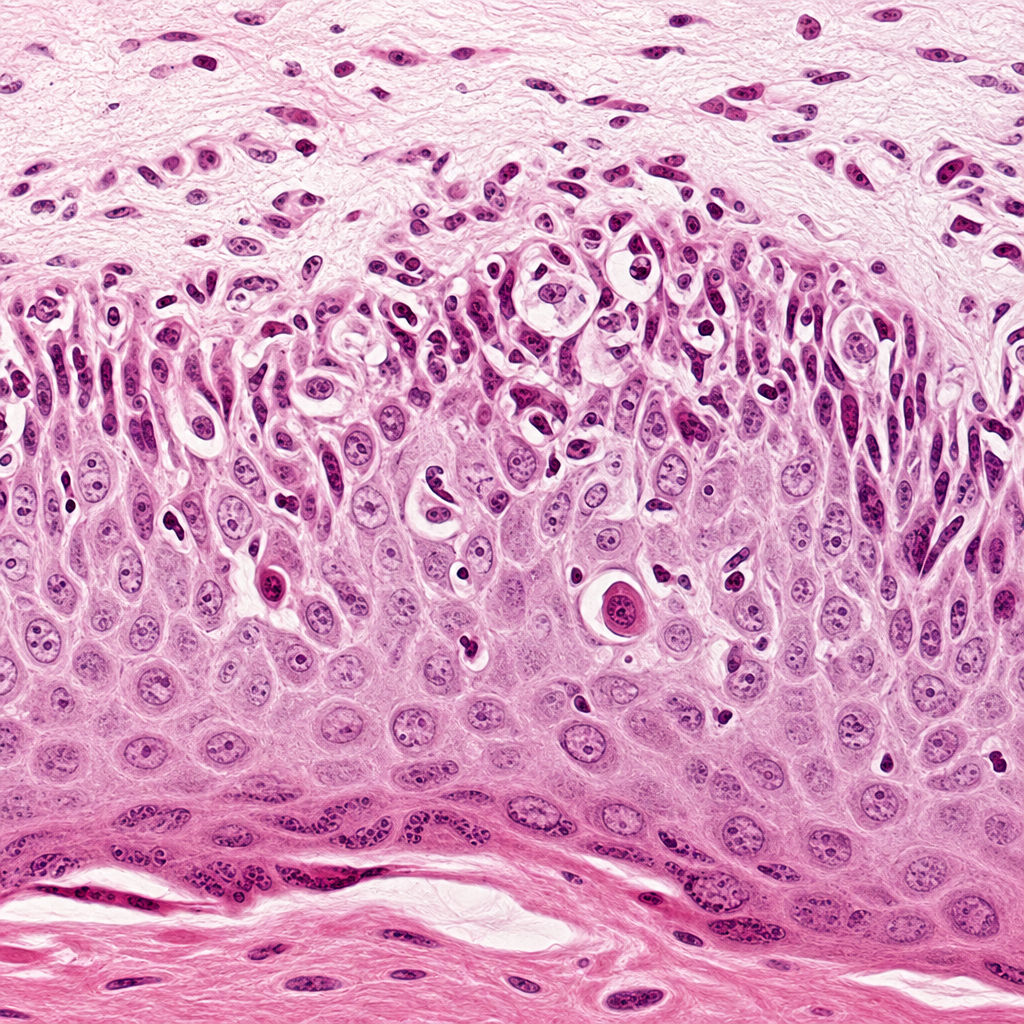 case-08 بیوپسی پوست