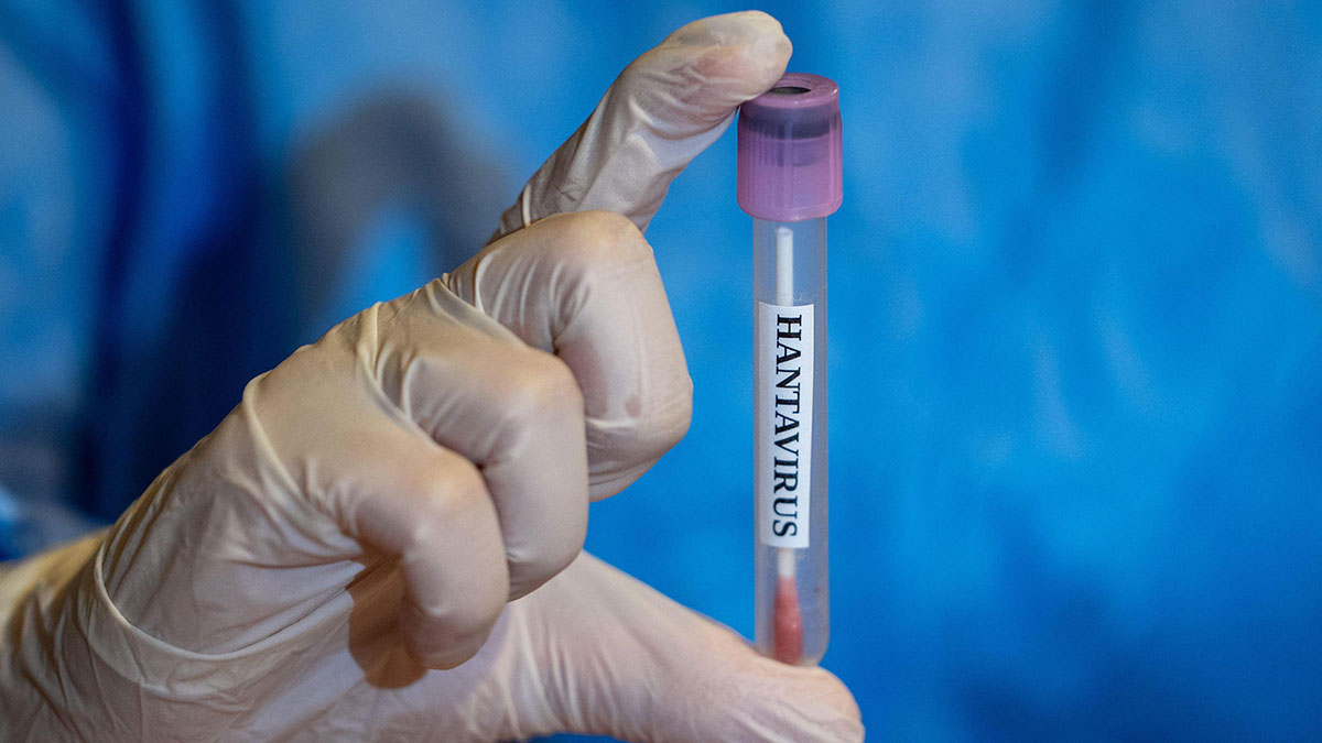 داروی و دمان hantavirus