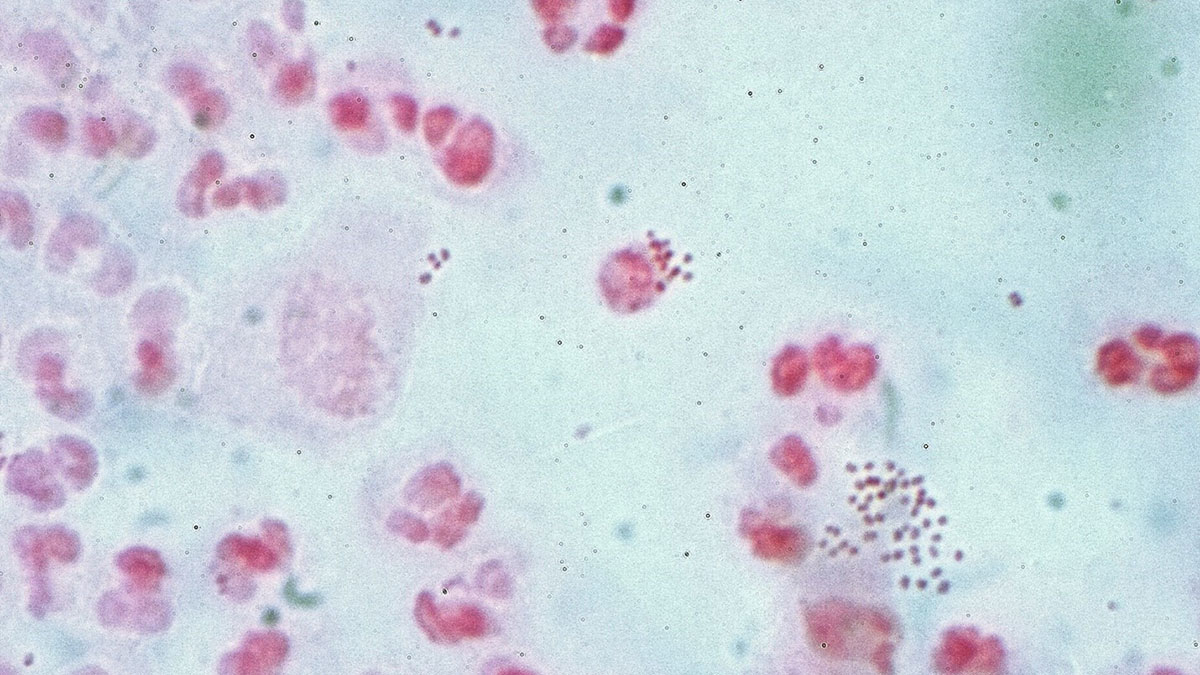 microbe-vs-microorganism اهمیت شناخت تفاوت میکروب و پاتوژن در پزشکی