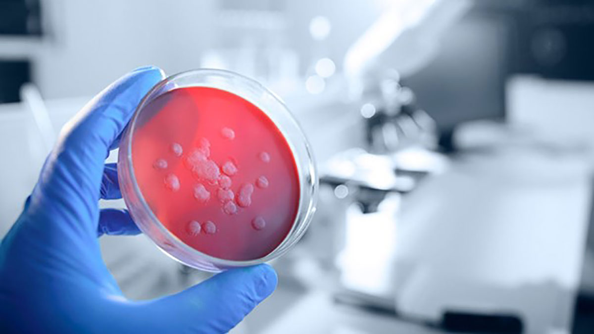 pathogen پاتوژن چیست؟