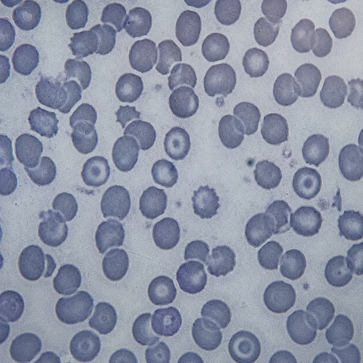 case-72 سلولهای هدف
