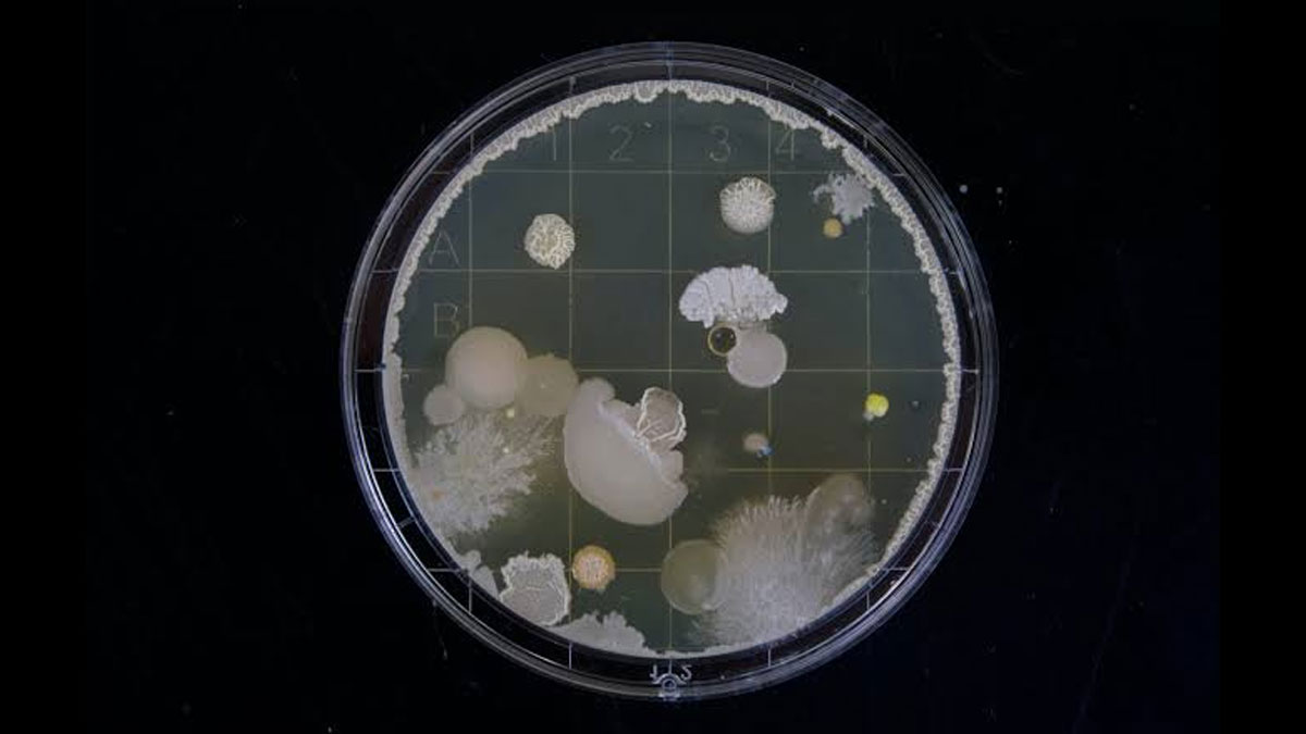 maldi-tof-moving-from-colonies-to-blood-cultures-and-biofilms MALDI-TOF به تشخیص بالینی