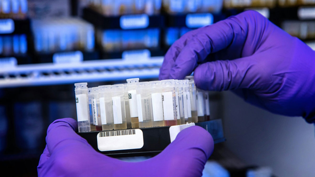 microbial-identification-by-maldi-tof-moving طیفسنجی جرمی زمان پرواز با یونیزاسیون/واجذب لیزری به کمک ماتریس یا MALDI-TOF،