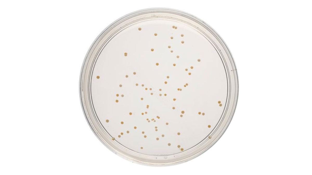 Ingredients-of-R2A-media ویژگی کلنی در محیط کشت R2A