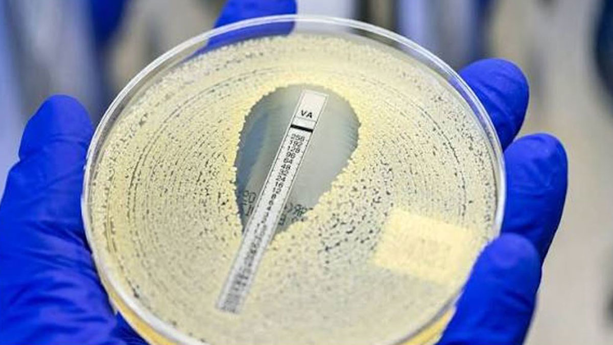 شیوع مقاومت MRSA