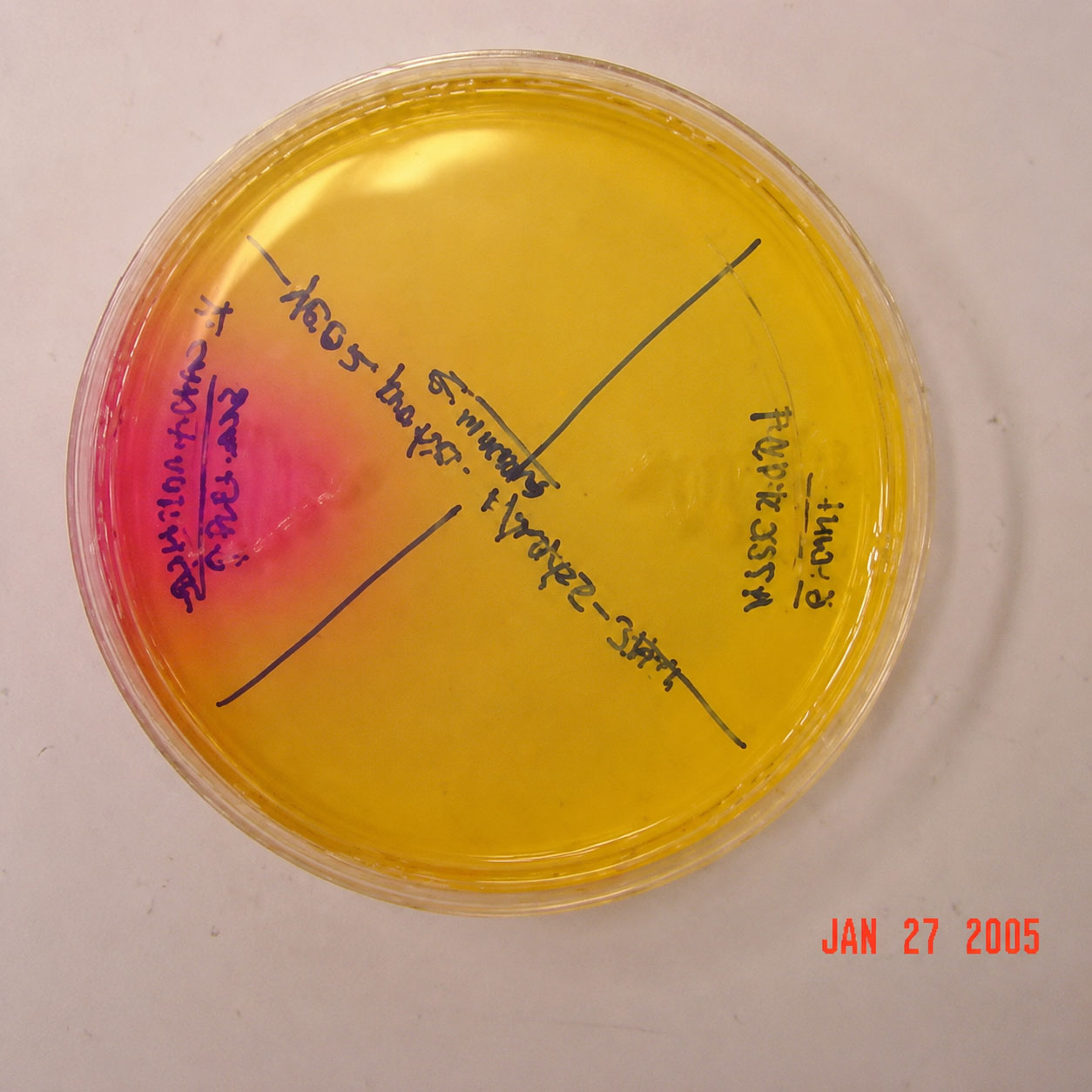 یرسینیا در christensen's-urea-agar