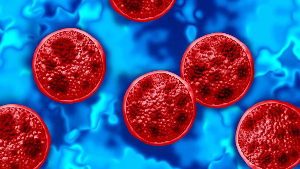 چالش‌های تشخیص آزمایشگاهی Cyclospora