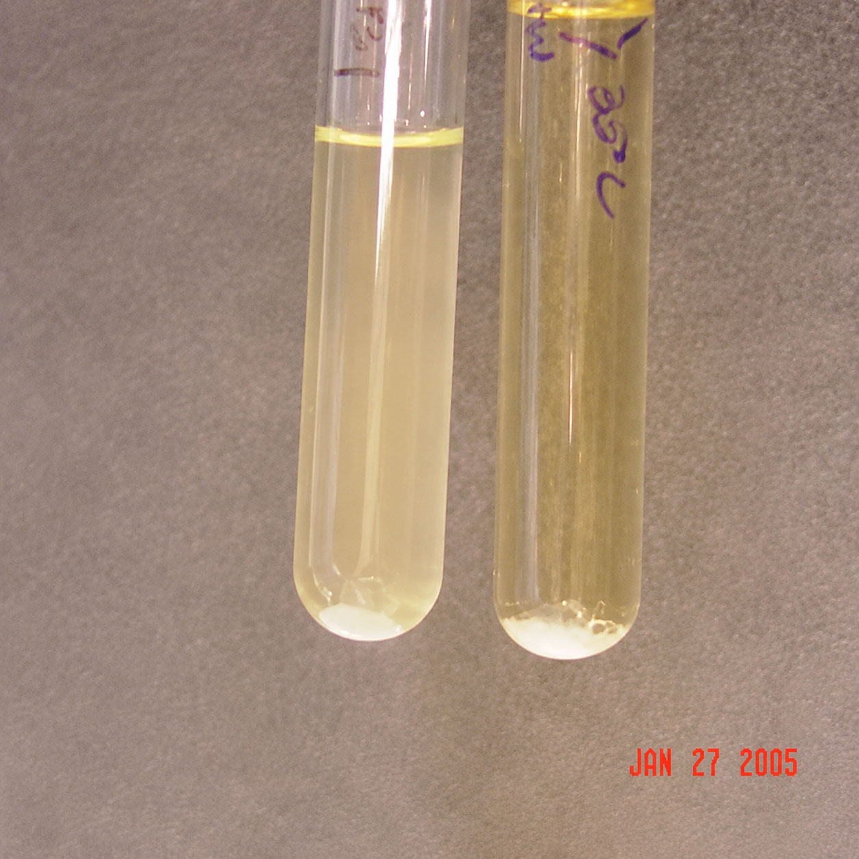 mrvp-agglutination-test