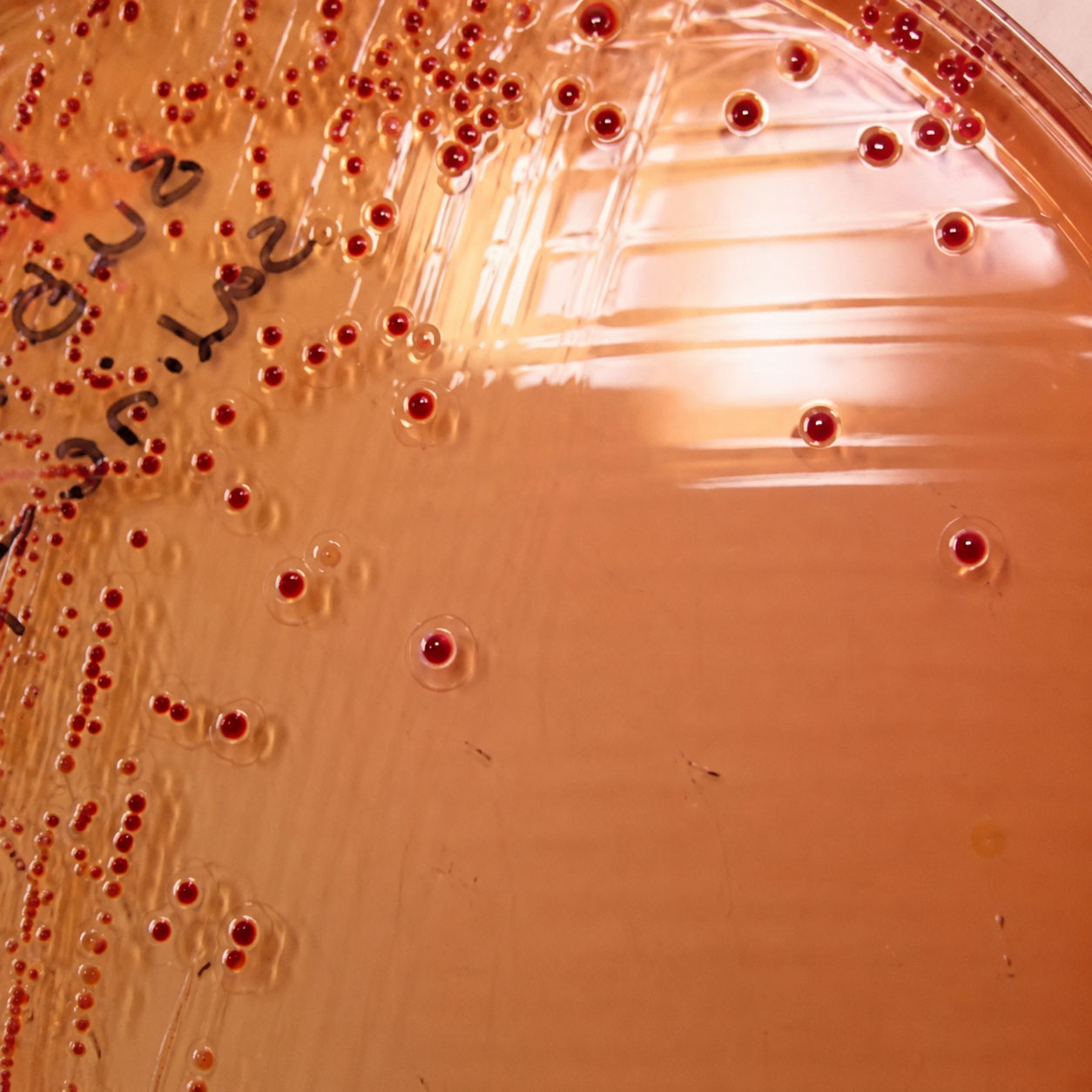 گونه های یرسینیا در YSA-CIN-agar