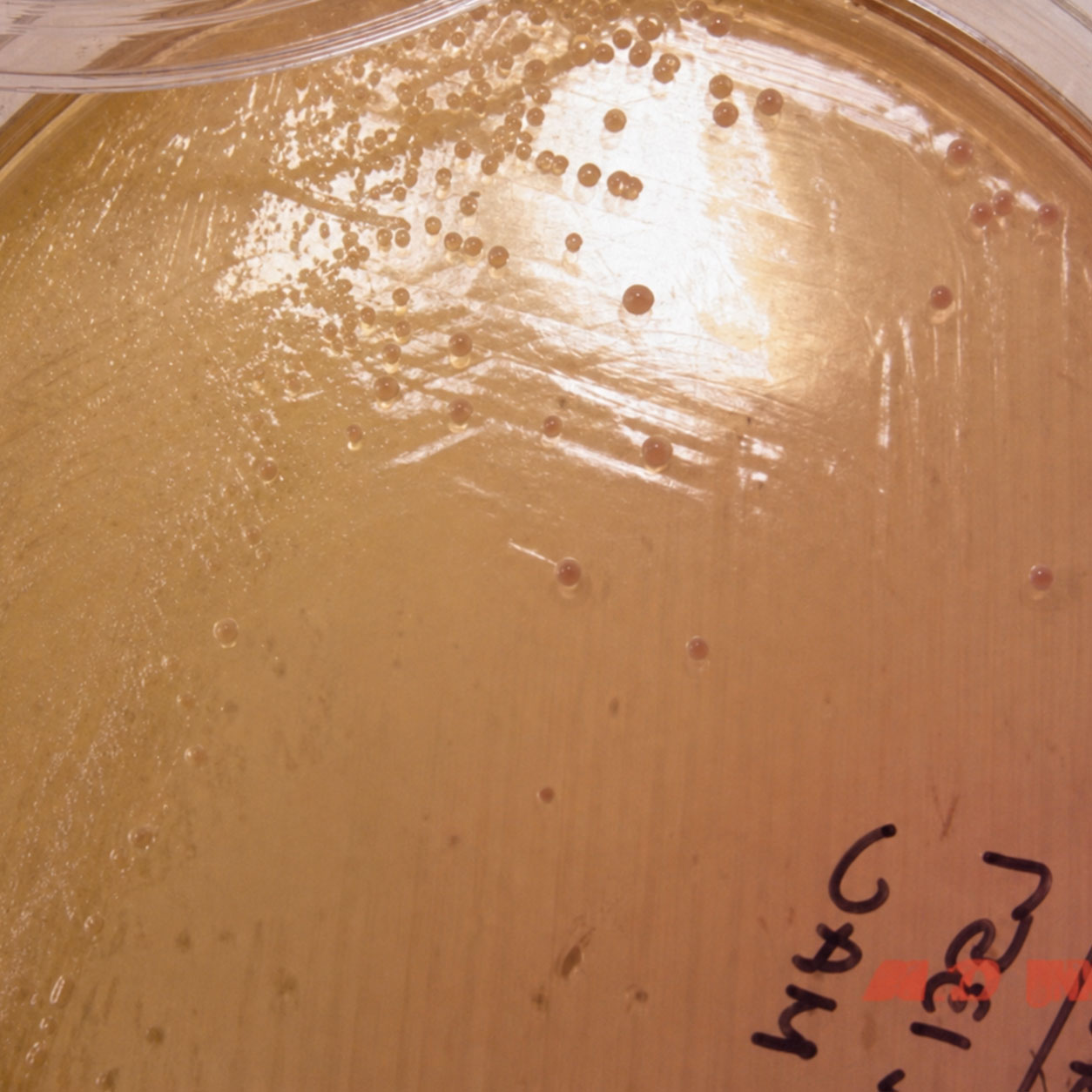 یرسینیا در MacConkey Agar