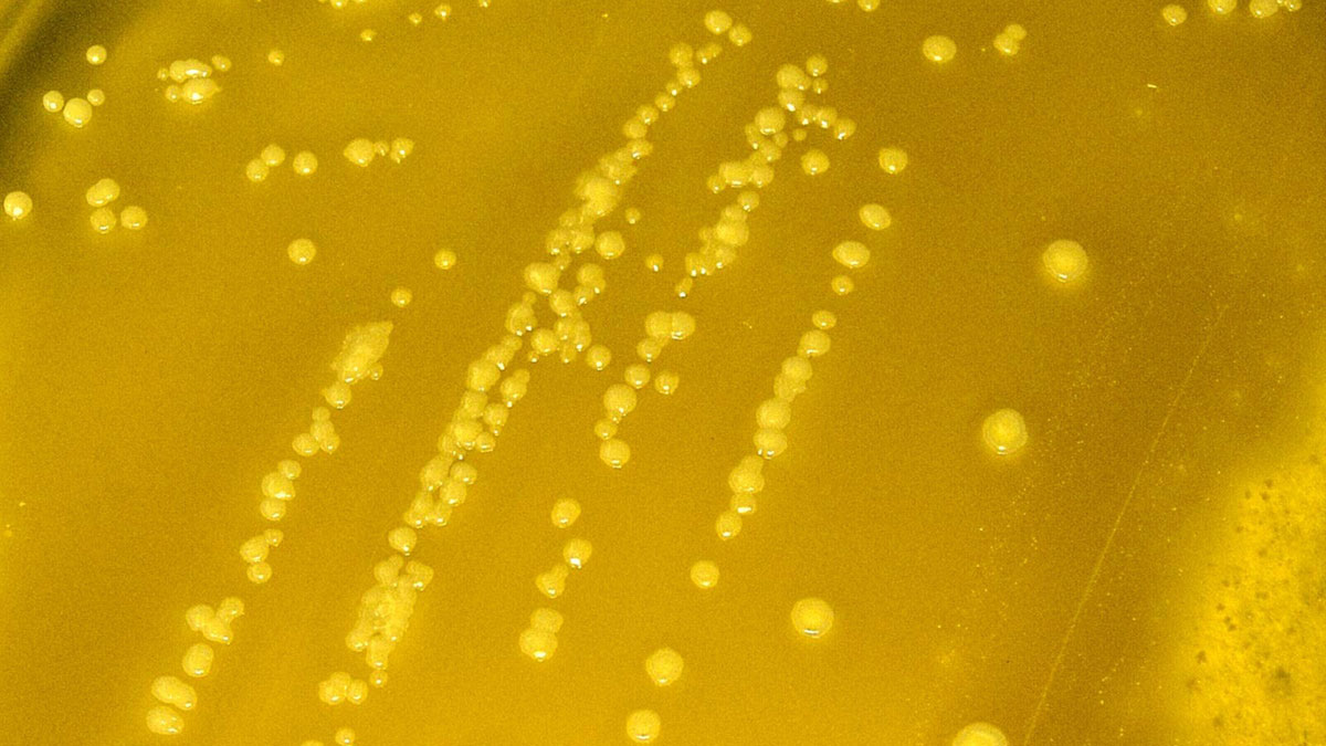 yersinia-pseudotuberculosis