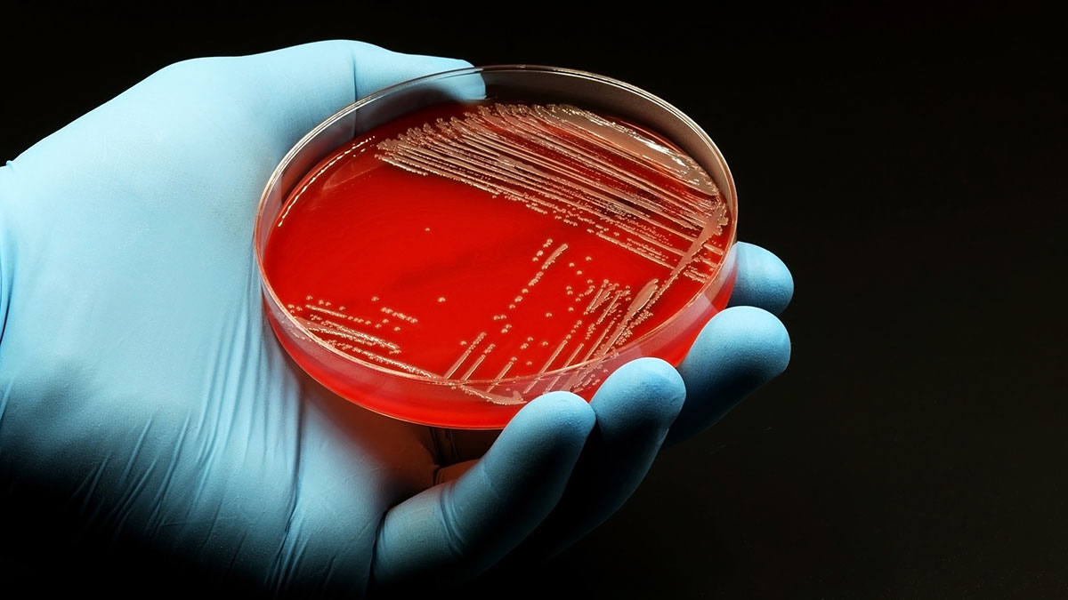 کمپیلوباکتر ژژونی (Campylobacter jejuni)